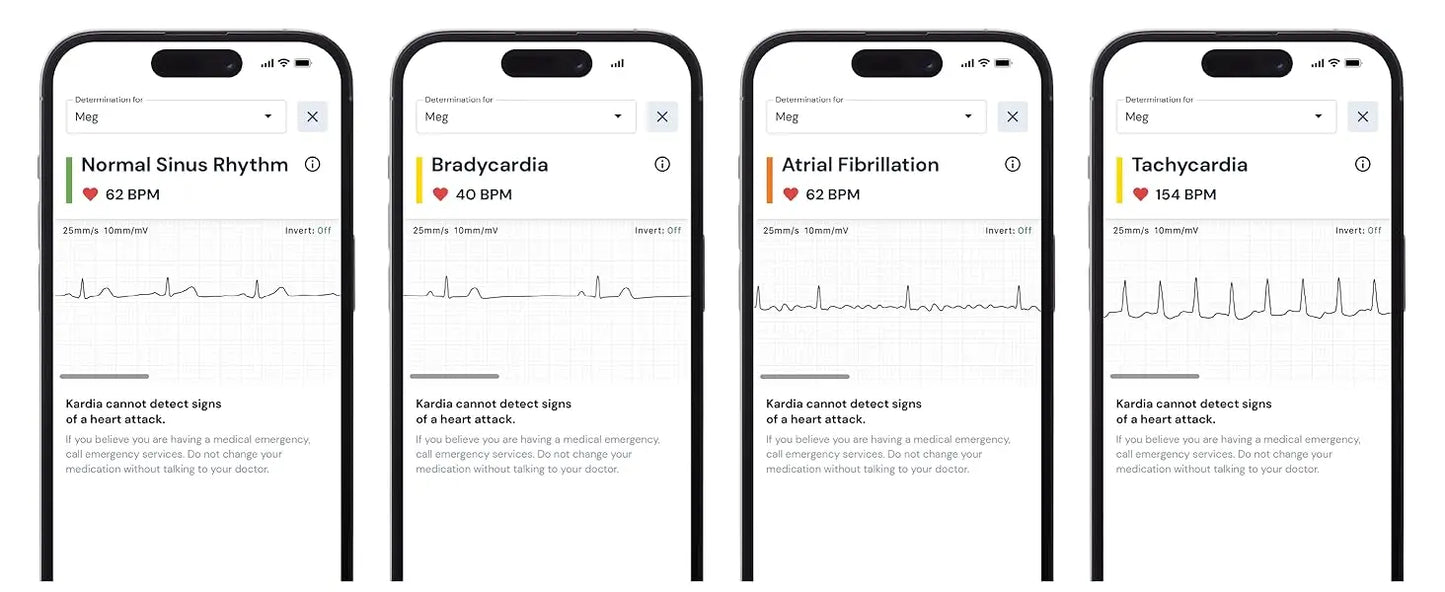 1-Lead Personal EKG Monitor  Record at Home  Detects AFib & Irregular Arrhythmias  Easy Results in 30 Seconds