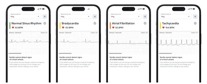 1-Lead Personal EKG Monitor  Record at Home  Detects AFib & Irregular Arrhythmias  Easy Results in 30 Seconds